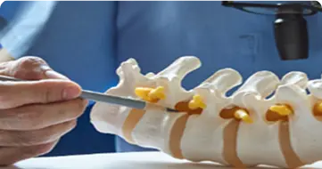 Doctor explaining spinal care model